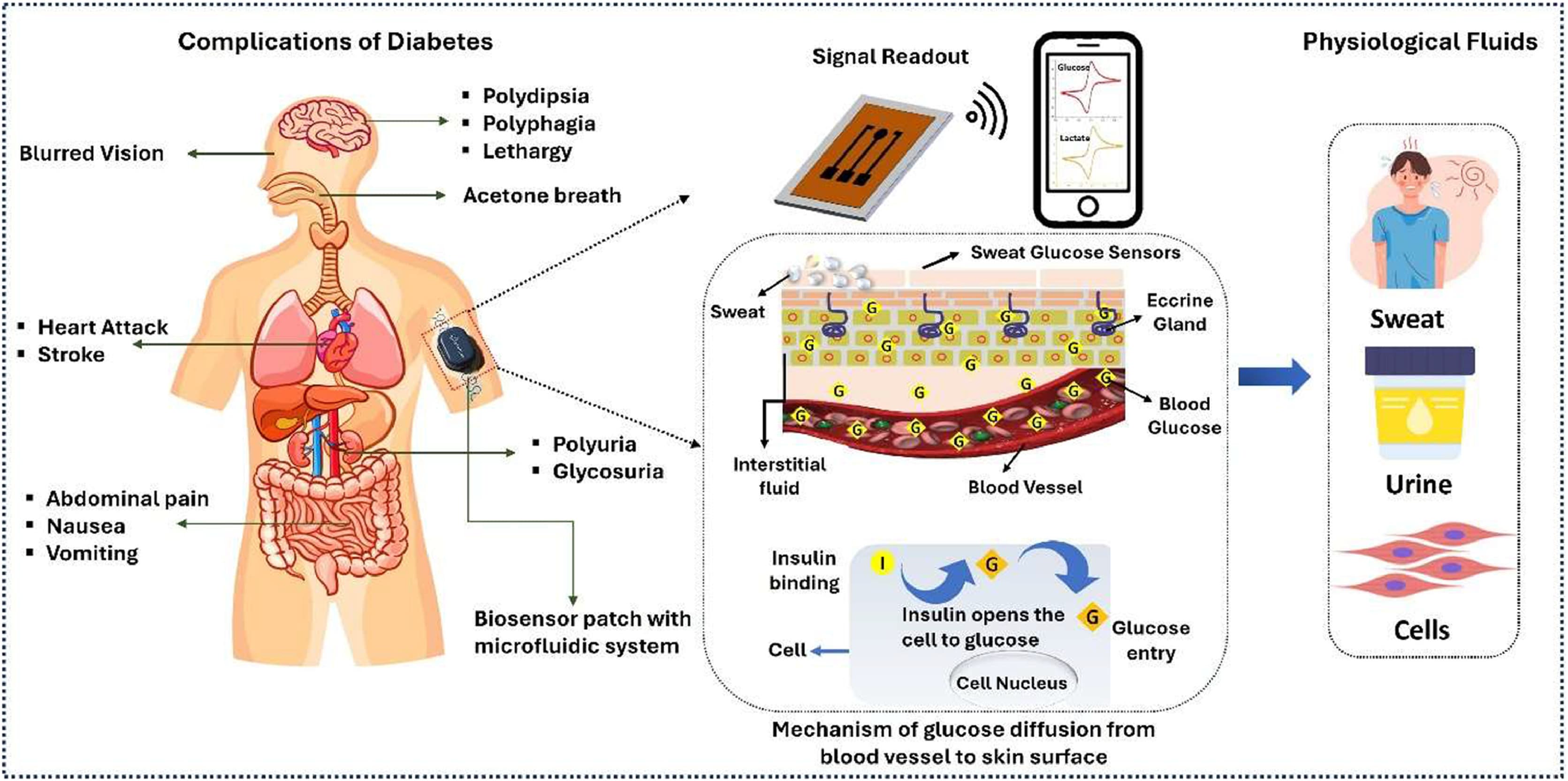 Multiplex Glucose & Lactate Monitoring